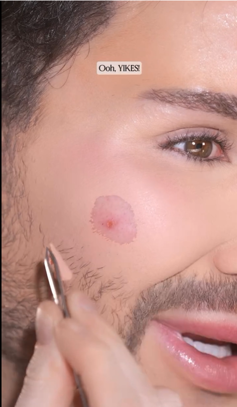 FINESSED TIPS: Painted By Spencer’s Make Up Hack for a Sudden Break Out!